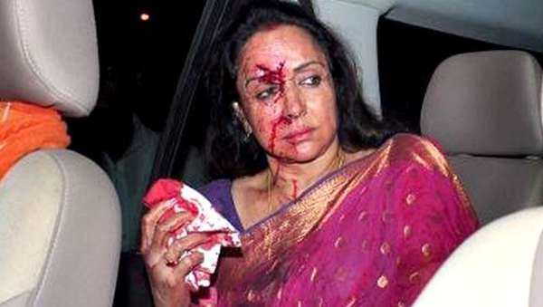 Hema Malini crash 1