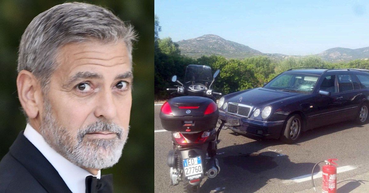 Actor George Clooney Injured in Scooter Accident Feature Image